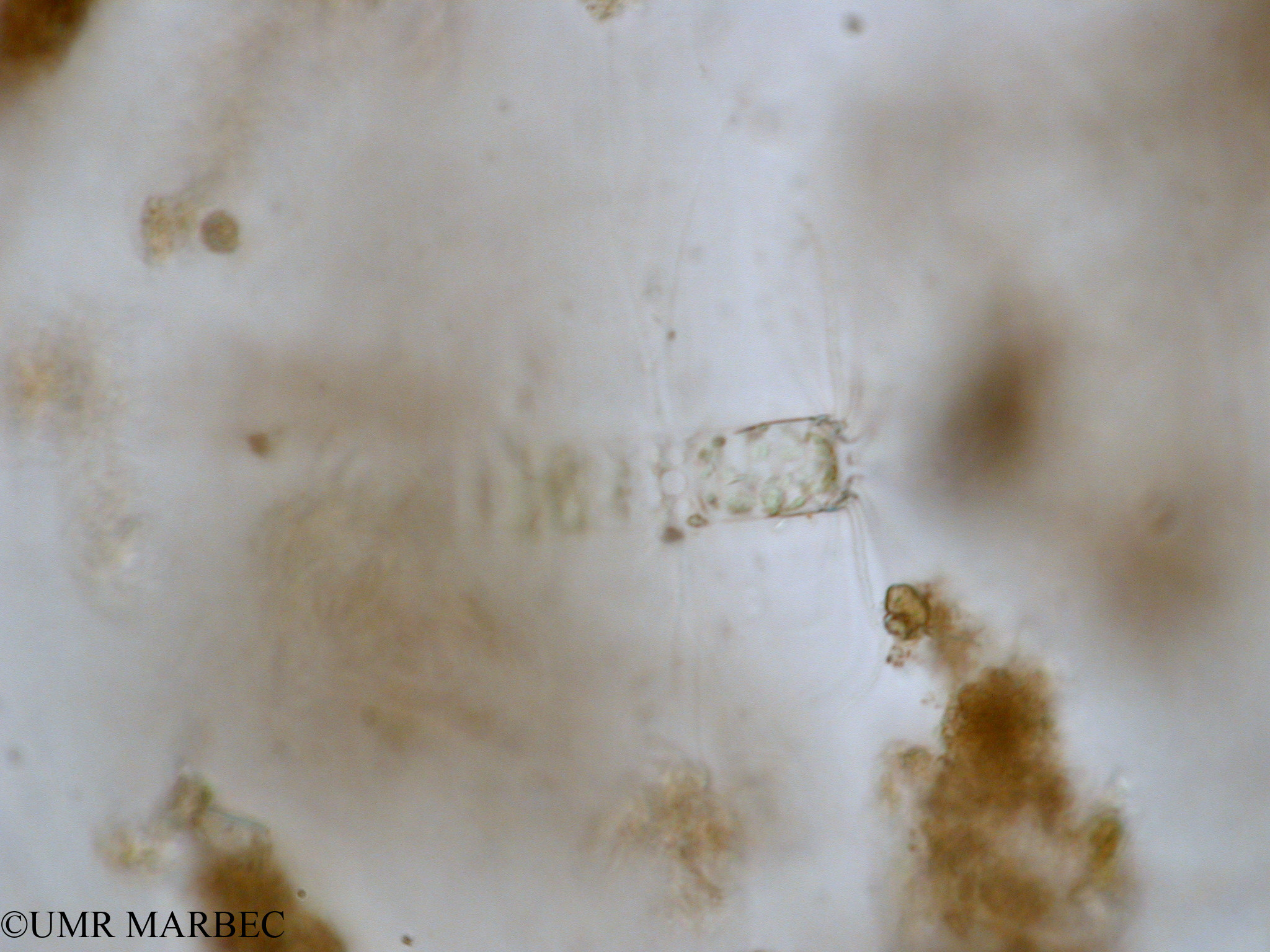 phyto/Tulear Lagoon/all/ICAR2 Avril 2008/Bacteriastrum delicatulum (Chaetoceros sp 5 x1.5x40)(copy).jpg